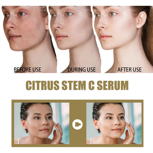 Delay Wrinkles Serum – Citrus Stem C Anti-Aging Formula